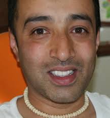 Lakhbir Gill UK NRI Full mouth oral rehablitation. 2 immediate loading dental implants and 3 unit ... - DSC07897.109202757_std