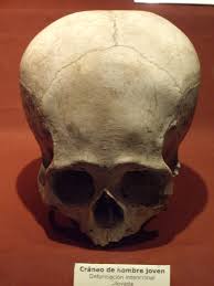 Résultat de recherche d'images pour "elongated skulls"