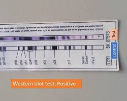 Obraz: Western blot test result