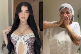 Karely Ruiz presume el resultado de su cirugía estética: “Estoy tan feliz”