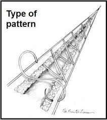 Image result for simple continuous suture pattern