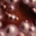 Tropical ailments: How to treat dreaded wet season skin fungus and...