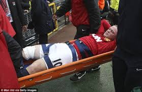 Image result for PIC OF INJURED ROONEY