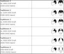Haartransplantation kosten pro graft