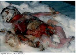 Resultado de imagen para tanatologia forense