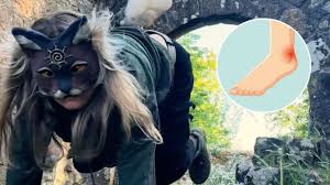 Mujer asegura que un “therian” mordió a su hija a plena luz del día