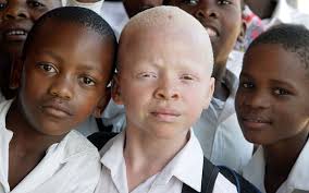 Image result for PICHA YA ALBINO