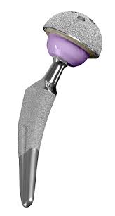 Hip Reconstruction | Globus Medical