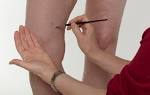 Hiding varicose veins with makeup