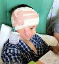 Cameron Whithers, 8, 'lucky to be alive' after Border Collie mauls ... - article-2004206-0C96D52200000578-23_468x506