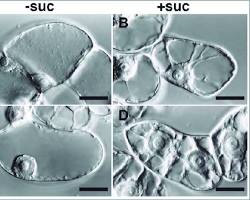 Image of BY2 cells under a microscope