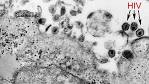 HIV-Forschung - Wissenschaftler testen neue Impfmethode gegen
