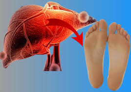 Your Feet Could be Pointing at a Liver Issue | by Zstein ...
