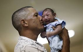 Image result for effect of zika virus on babies