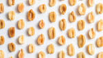  Peanut allergy is one of the most severe food allergies. New therapies might help.