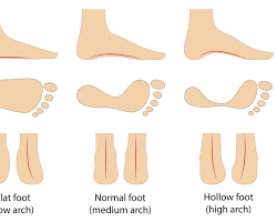 Normal arches