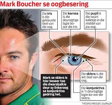 Hoe Mark Boucher se oog beseer is. Posted July 11, 2012 by Graphics24 - Mark-Boucher-se-oogbesering-WP