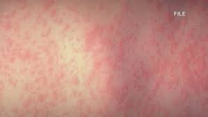 Vaccination Awareness