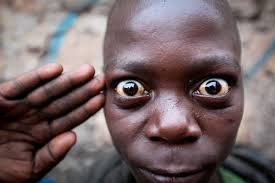 Résultat de recherche d'images pour "extreme poverty"