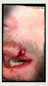 Resultado de imagem para foto ilustrada de um homem sendo agredido