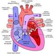 Salud: Hidrocefalia