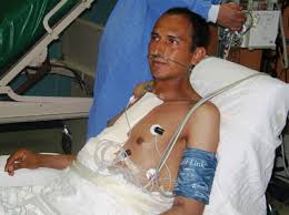 Resultado de imagen para fotos de transplante de corazon