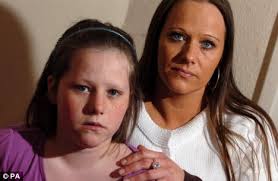 Burned: Kelly Thompson with her mother Sharon Hannaford. The schoolgirl suffered burns on over 70 per cent of her body after a 16-minute sunbed session - article-0-04C5F9BE000005DC-319_468x305