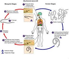 Image result for filariasis meaning