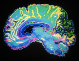 Unveiling the Detrimental Effects of Chronic Cocaine or Alcohol Use on Cognitive Flexibility - 10