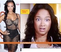 Resultado de imagem para before after surgery