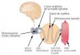 Syndrome de Guillain-Barr