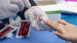 ¡Urgente! El VIH ya no es mortal: Avances que cambiarán tu vida