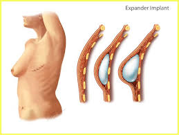 Related image