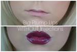 Plump lips without injections