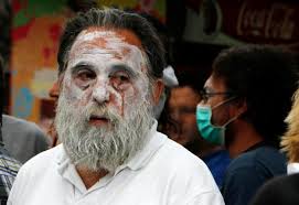 A demonstrator with his face covered in a cream to guard against the effects of tear gas during a demonstration in Athens, Tuesday June 28, 2011. - pict13