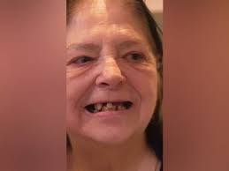 Yvonne Lillegaard har ikke været ved tandlæge, siden hun var 17 år