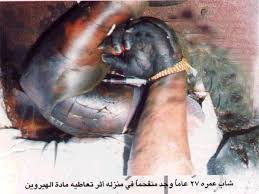 نتيجة بحث الصور عن صور ادمان المخدرات