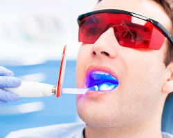 Imagem de Laseres em odontologia