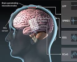 Imagem de BrainComputer Interfaces for Speech Prostheses