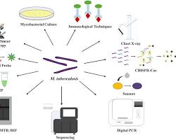 Image of tuberculosis diagnostic methods
