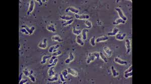 Amoeba