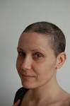No EyelashesBrows Still! - Breast Cancer Care Forum - 632834