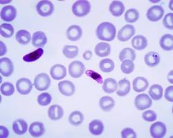 Hình ảnh về Plasmodium falciparum