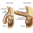 Maintenir erection