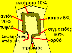 Αποτέλεσμα εικόνας για κολονοσκόπηση