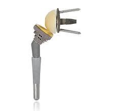 Reverse shoulder prosthesis - Mirai® - Permedica ...
