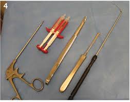 Image result for tonsil syringe