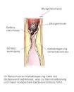 Ginkgo Heilpflanzen-Lexikon Apotheken Umschau