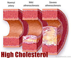 Image result for cholesterol