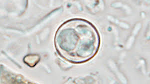 Missouri has third-highest number of cyclosporiasis cases in U.S., CDC says